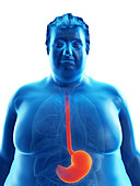 Illustration of an obese man's stomach