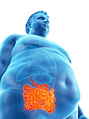 Illustration of an obese man's intestine