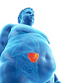 Illustration of an obese man's spleen