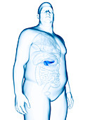 Illustration of an obese man's pancreas