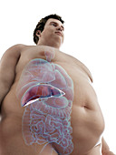 Illustration of an obese man's liver