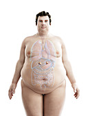 Illustration of an obese man's adrenal glands