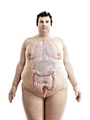 Illustration of an obese man's colon