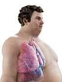 Illustration of an obese man's organs