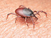 Illustration of a tick crawling on human skin