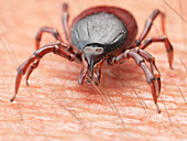 Illustration of a tick crawling on human skin