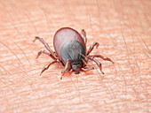 Illustration of a tick biting human skin