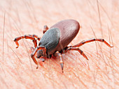 Illustration of a tick biting human skin