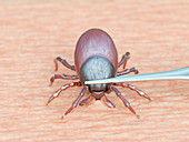 Illustration of a tick being removed