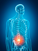 Illustration of painful lower spine