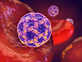 Norovirus infection, illustration