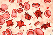 Acanthocyte abnormal red blood cells, illustration