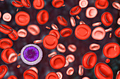 Blood after hemotransfusion for anaemia, illustration