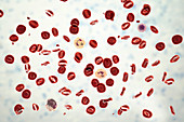 Normal blood smear, illustration