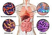 Bacteria that cause human infections, illustration