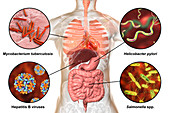 Bacteria that cause human infections, illustration