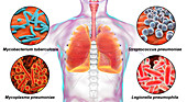 Bacteria that cause lung infections, illustration