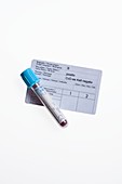 Blood group test with certificate and blood sample