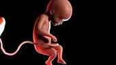 22 week old fetus
