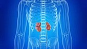 Tumours in the kidney