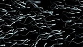 Human sperm