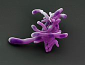 Corynebacterium diphtheriae bacteria, SEM