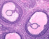 Ovarian follicular atresia,light micrograph