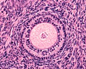 Ovarian secondary follicle,light micrograph