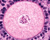 Oocyte in ovary,light micrograph