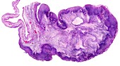 Menopausal human ovary,light micrograph