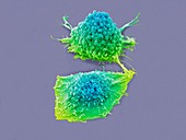 Lung cancer cells,SEM