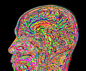 Human head and brain,3D MRI scan