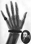 X-ray photograph of a hand, 1926