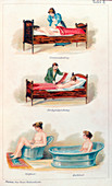Hydrotherapy treatments, c1902
