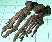 A Late Saxon Norman woman's skeletal feet, 11th-12th century