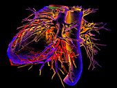 Human heart, 3D CT scan