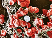 Red and white blood cells in clot, SEM