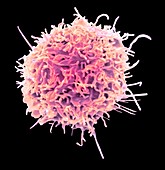 Lymphoma cancer cell.