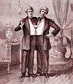 Chang and Eng conjoined twins, 19th century