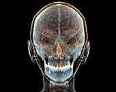 Normal human brain, 3D CT scan