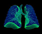 Human lungs, 3D CT scan