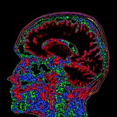 Human head and brain, sagittal MRI scan