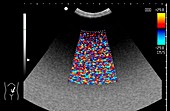 Doppler ultrasound test image