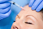 Botox treatment