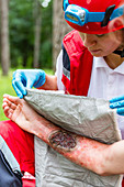 Medical worker treating burns on man's arm