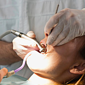 Dental treatment