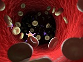 Diseased blood cells, illustration