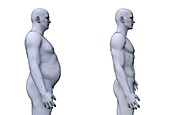 Comparison of a fit and obese male, illustration