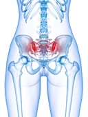 Lower back pain, conceptual illustration