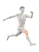 Runner with knee pain, conceptual illustration